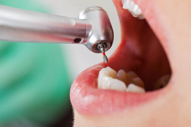 Trusted MA Emergency Dental Service Experts
